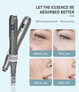 Dr Pen- Ultimate Microneedling Pen